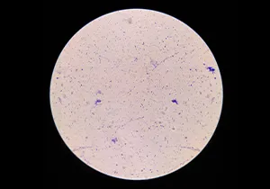 تفكيك خلايا  Lactobacillus